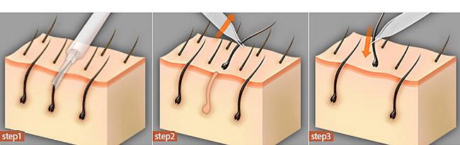 福州祛痣醫(yī)院推薦！快速了解前八家信譽(yù)口碑醫(yī)院