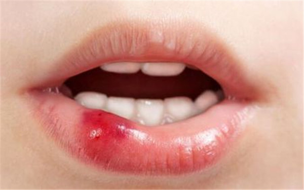 杭州面部溶脂手術醫(yī)生