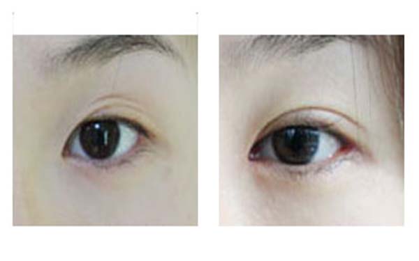 熱瑪吉整形醫(yī)院最受好評的六個機構(gòu)合集！尋找這些隱藏的寶藏醫(yī)院，分享給你，讓你重拾自信！