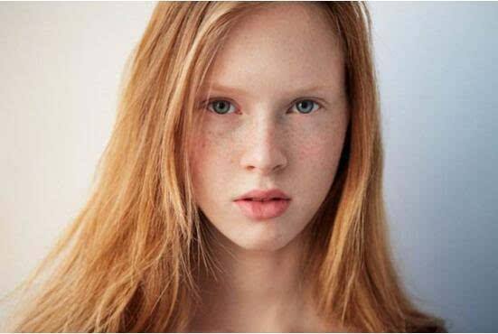 長沙治療老年斑醫(yī)生