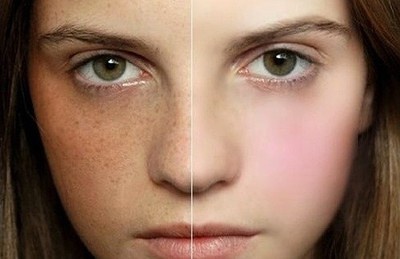 太原水光針去除動(dòng)態(tài)細(xì)紋醫(yī)生