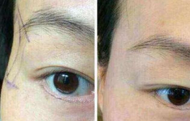 青島市祛斑醫(yī)院對(duì)比排行榜：公立私立均有上榜，詳盡評(píng)估剖析