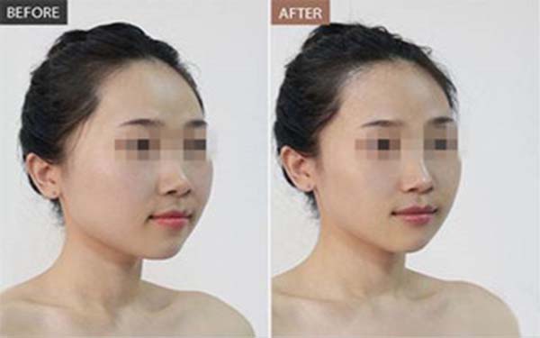 黃石市最好的雙眼皮醫(yī)院推薦TOP5，公私醫(yī)院評價大揭秘