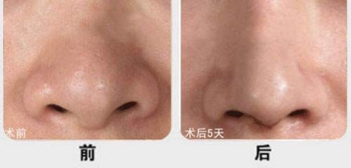 廈門市有哪些醫(yī)院提供優(yōu)質(zhì)的脂肪填充服務(wù)？江頭醫(yī)院、臉康整形醫(yī)院、美麗醫(yī)療中心等值得一看！快來了解一下