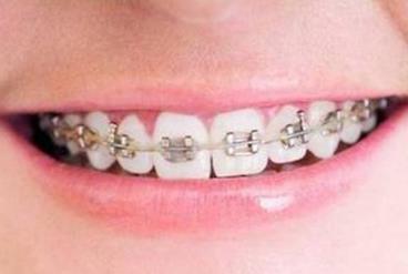 重慶激光洗紋身整形醫(yī)院聚焦盛夏排行榜，單品強(qiáng)力推薦！