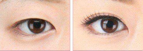 鄭州特色牙齒種植醫(yī)院排行榜：這些機構(gòu)守護你的口腔健康