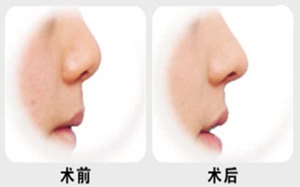 陜西地區(qū)頂級(jí)整形醫(yī)院排名揭曉！信賴度高，公立和私立可靠權(quán)威推薦！