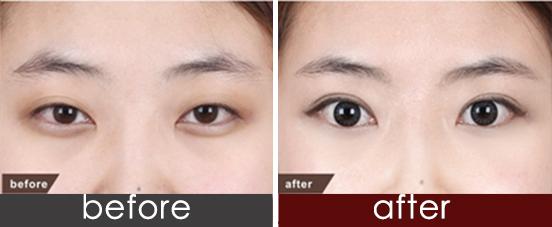 衡陽填充除皺醫(yī)生