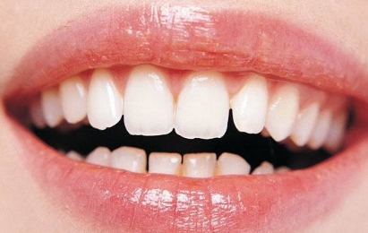 2023年，哪家醫(yī)院在武漢提供高質量的無痕隆胸手術？