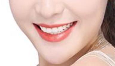 廈門電動負(fù)壓吸脂去雙下巴醫(yī)生