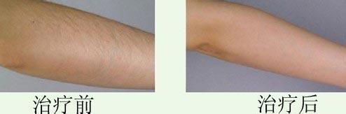 連云港哪些整形美容醫(yī)院在2023年在玻尿酸頸紋填充方面有口碑？十大排名新鮮出爐！