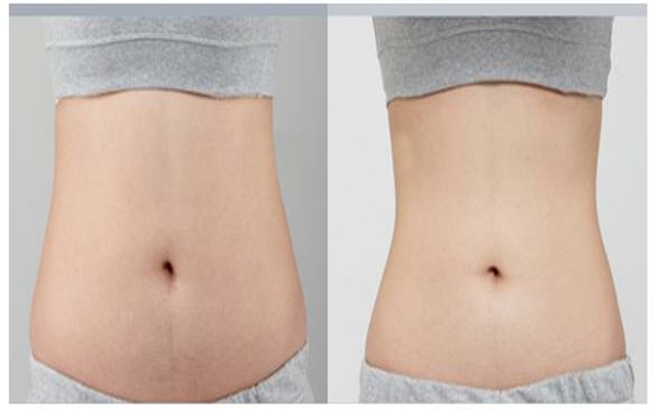 2023年貴陽哪家雙眼皮整形醫(yī)院口碑，排名前10強(qiáng)整容美容醫(yī)院全揭秘