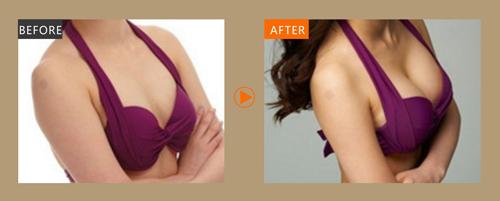 青島唇紋射頻去除醫(yī)生