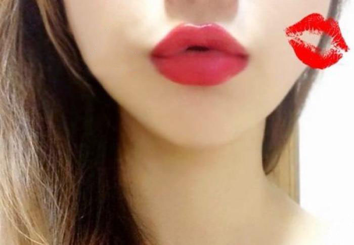 銀川激光美白祛斑手術(shù)醫(yī)生