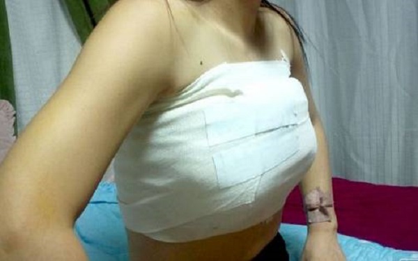 鄭州哪家整形醫(yī)院能讓您擁有完美豐唇？2023年排名前十的鄭州豐唇整形醫(yī)院是哪些？