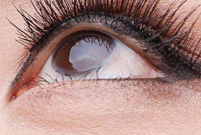 2023汕頭比較推崇的超皮秒祛斑醫(yī)療美容醫(yī)院排名前十強