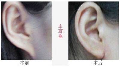 2023沈陽(yáng)去魚(yú)尾紋雕塑醫(yī)院排行榜，這十家都備受口碑推崇！