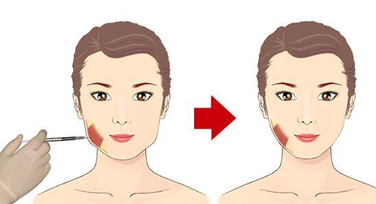 2023烏魯木齊去黑眼圈整形醫(yī)院排行榜揭曉！高性價比的醫(yī)院有哪些？