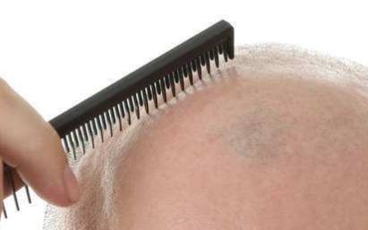 2023年度，沈陽整形美容醫(yī)院榜單公布！揭秘沈陽眾多醫(yī)院哪家豐下巴手術(shù)值得去