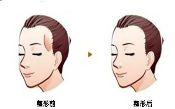 西寧顴骨矯正術(shù)：哪家醫(yī)院口碑好？2023年口碑排名前10的正規(guī)醫(yī)療整形醫(yī)院公布！