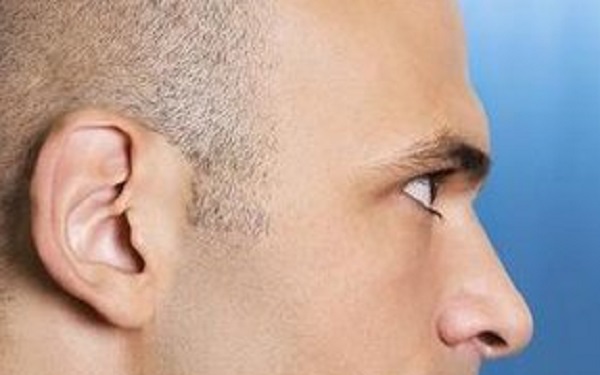 深圳哪幾家醫(yī)院能有效去除眼紋？2023年深圳比較好的眼紋去除醫(yī)院排名前十位解析！