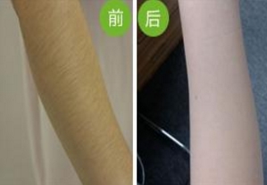 哪家南京雙眼皮手術(shù)醫(yī)院口碑好？2023年南京韓式雙眼皮手術(shù)前十名排序！