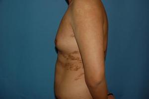 濟(jì)寧哪家醫(yī)院玻尿酸填充手術(shù)技術(shù)專業(yè)？2023年榜單首席整形醫(yī)院揭曉！