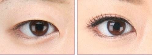 【2023成都光波去雀斑】Top10名單揭曉！讓你遠離雀斑煩惱，品質(zhì)醫(yī)美醫(yī)院推薦！