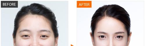 2023淮安酒渣鼻治療排名前10的專業(yè)醫(yī)院匯總