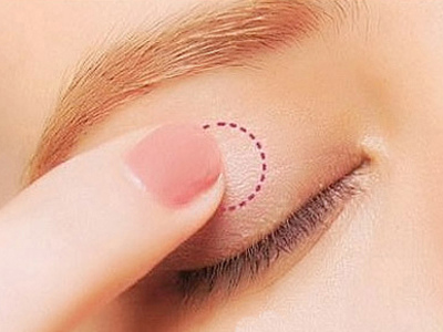 2023武漢細(xì)紋消除：查閱全網(wǎng)評(píng)分前十的權(quán)威整形醫(yī)院名單揭曉！