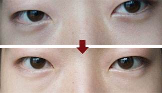 南京哪家醫(yī)院治療黃褐斑比較有口碑？2023南京微針美塑祛斑?？漆t(yī)院排行榜發(fā)布！