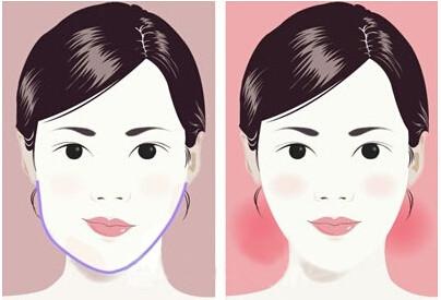 沈陽(yáng)無(wú)痕除皺術(shù)：2023年，擁有卓越口碑的專(zhuān)業(yè)醫(yī)院排行榜前十揭曉！