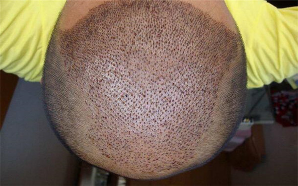 2023鄂爾多斯光子祛斑整形醫(yī)院排名前十引爆話題！哪家美容祛斑醫(yī)院比較有口碑？