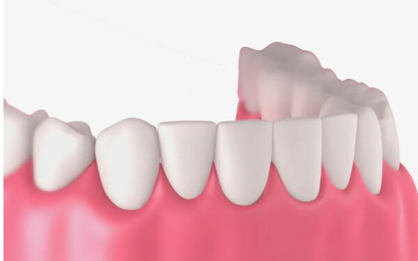 揭秘2023年溫州特色內(nèi)窺鏡額部除皺醫(yī)療美容醫(yī)院排行榜！這些醫(yī)院的名氣有多大？