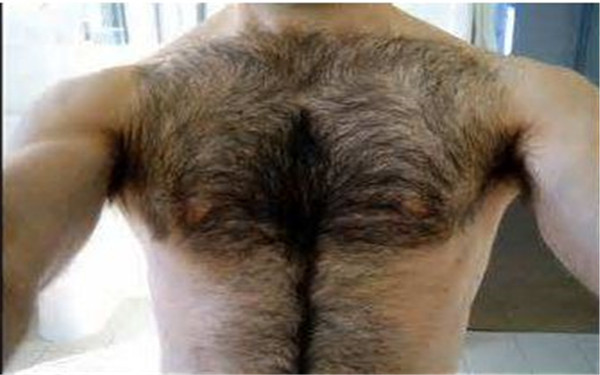 2023年寧波去唇紋排行前十強醫(yī)院推薦！比較正規(guī)的自體填充醫(yī)院有哪些？