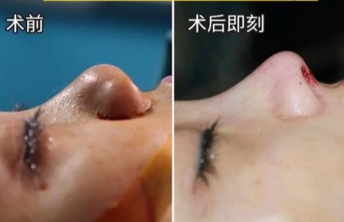 南京最熱門的環(huán)形精雕吸脂醫(yī)療美容醫(yī)院綜合推薦！2023年排行前十名大揭曉！