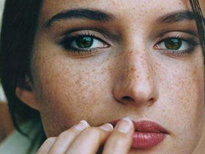 樂清m22非剝脫點陣激光醫(yī)生