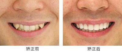 高性價(jià)比的滁州曼托水滴型假體隆胸整形醫(yī)院推薦！2023年滁州曼托水滴型假體隆胸醫(yī)院TOP10口碑排行，實(shí)力醫(yī)