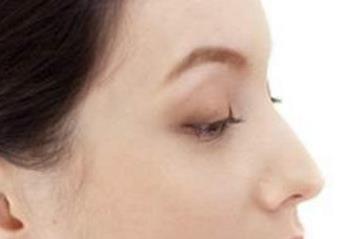 寧波玻尿酸面部精細(xì)化美學(xué)注射醫(yī)生