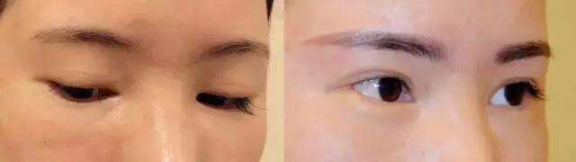 比較好的石家莊埋線提升面部輪廓整形醫(yī)院排行榜2023