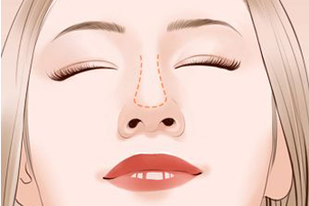 曲靖瘦臉瘦腿醫(yī)生