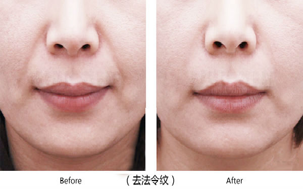 大連光電面部提拉醫(yī)院評價優(yōu)秀的有哪些？2023年排行榜揭曉！