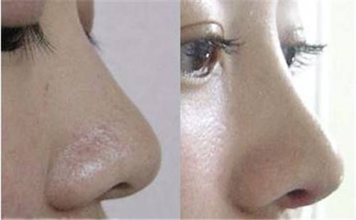 2023年北京填充川字紋凹陷醫(yī)療美容院排名前10的優(yōu)秀口碑醫(yī)院推薦，快速記錄！