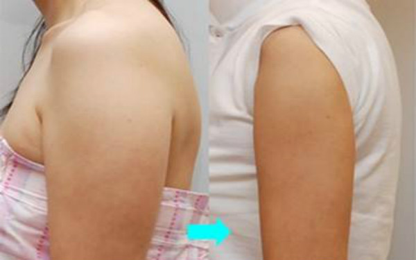 天津哪些整形美容醫(yī)院提供卓越的線雕去眼紋技術？2023比較推崇的天津線雕去眼紋前十佳整形醫(yī)院盤點！