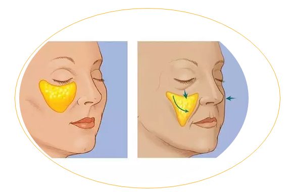 滄州哪家醫(yī)院治痘痘靠譜？推薦2023年口碑前十的權(quán)威整形美容醫(yī)院！