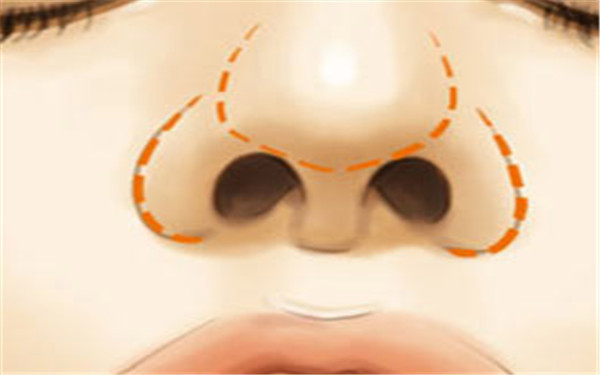 成都老年斑淡化的高級(jí)整形醫(yī)院哪家口碑比較好？最新排名公布！