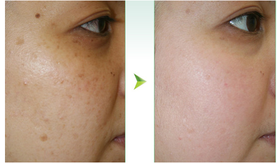 上海無針去淚溝整形醫(yī)院排行榜2023：口碑爆棚的十大醫(yī)院揭秘！