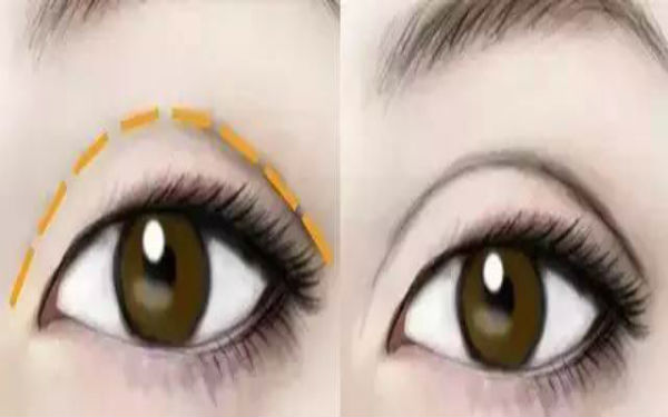 2023年南昌超皮秒去細(xì)紋排行榜公布！10家備受口碑推崇的整形美容醫(yī)院揭曉！