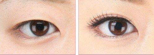 重慶有哪些口碑好的射頻點(diǎn)陣激光祛除疤痕醫(yī)療美容醫(yī)院？2023年排名前十的醫(yī)院哪家服務(wù)較佳？