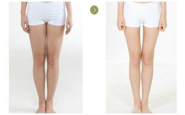 探尋煙臺綜合鼻美容醫(yī)院評價優(yōu)秀的特點(diǎn)！2023煙臺綜合鼻美容整形醫(yī)院口碑揭秘！